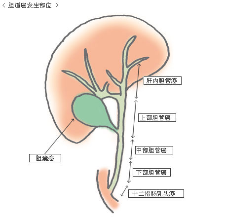 胆管癌的手术怎么要切除那么多部位呀